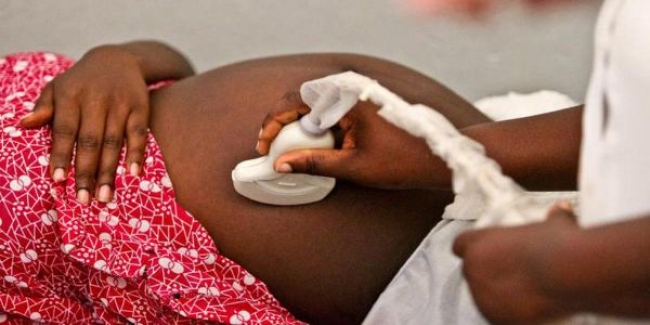 MAPUTO: COMPLICAÇÕES DE PARTO MATAM MAIS DE 80 MULHERES