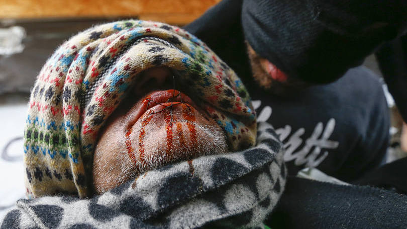 Calais: o gesto de costurar a própria boca já tinha sido usado por migrantes em novembro na Grécia