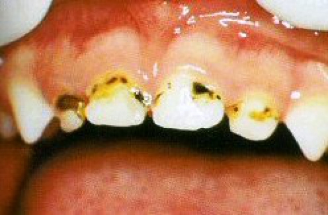 NAMPULA: SAÚDE EXPANDE SERVIÇOS DE ESTOMATOLOGIA ÀS UNIDADES SANITÁRIAS