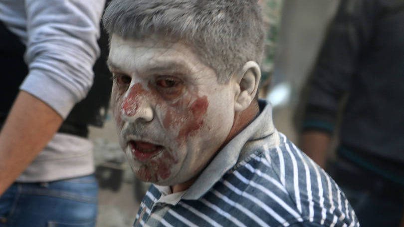 Homem ferido em bombardeio nas proximidades de Aleppo
