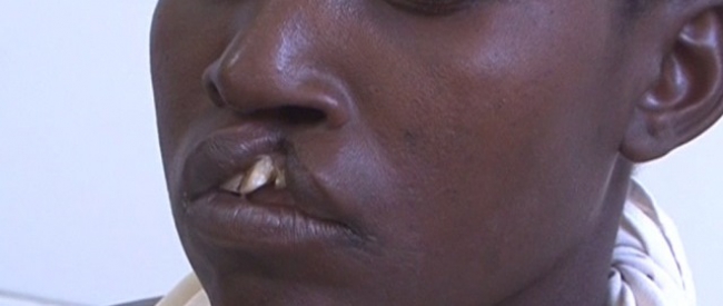 MÉDICOS NORTE-AMERICANOS VÃO EFECTUAR OPERAÇÕES EM CHIMOIO