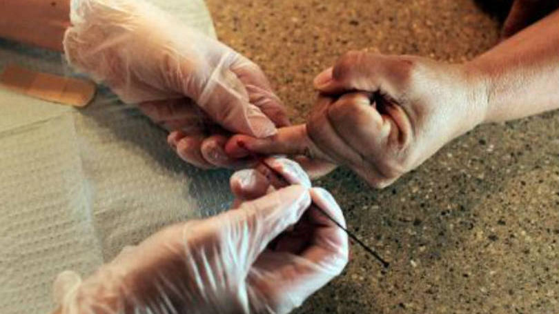 Colesterol: pesquisa trabalha em cápsulas que tiram partículas do colesterol do sangue