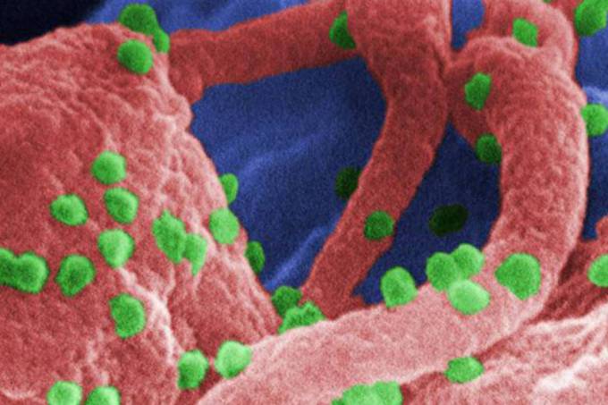 O vírus HIV, causador da Aids (CDC USA/)