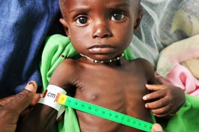 EM MOÇAMBIQUE, 36 POR CENTO DE CRIANÇAS MORREM ANTES DOS CINCO ANOS, POR DESNUTRIÇÃO