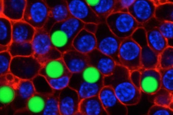 Síndrome de Richieri-Costa Pereira é uma doença autossômica recessiva descrita pela primeira vez em 1992
